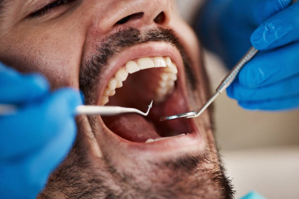 Best Emergency Root Canal Therapy in Fort Smith, AR